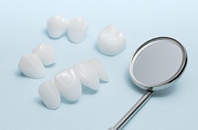 Porcelain veneers prior to placement