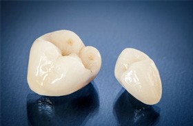 Two dental crowns of different sizes 