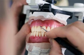 Close-up of lab technician’s hand working on dentures