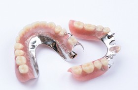 Two partial dentures with metal attachments arranged against neutral background