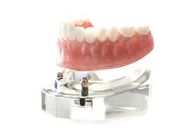 Implant denture being placed on model against white background