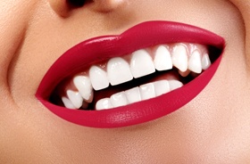 perfect teeth close-up