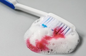 Toothpaste mixed with blood, indicative of gum disease