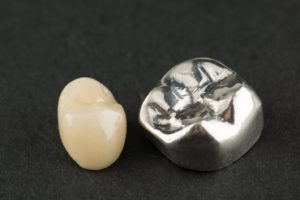 porcelain and metal dental crowns in Plymouth against dark background