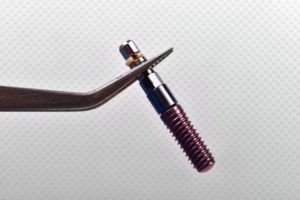 Dental instrument carefully removing failed implant in Plymouth